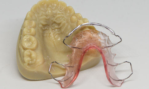 Caso de Éxito Dental Neo Lab Impresión 3D